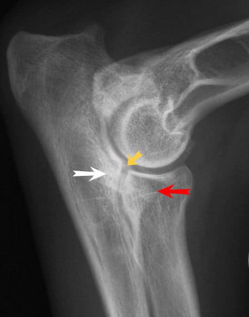Elbow Dysplasia Image