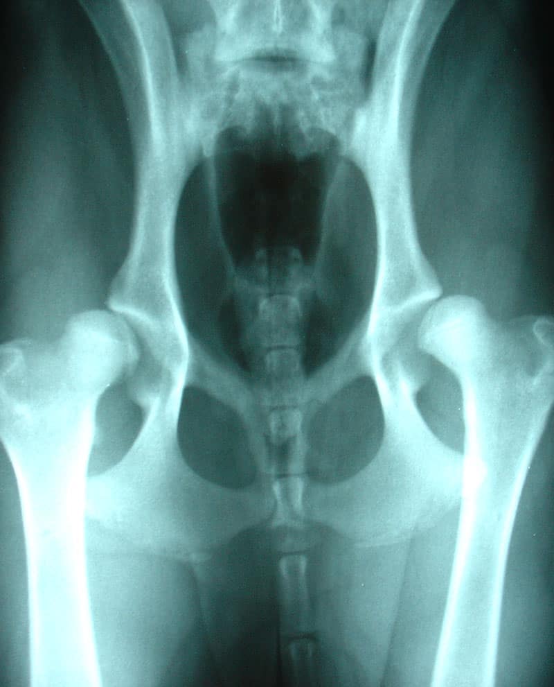 Hip Dysplasia