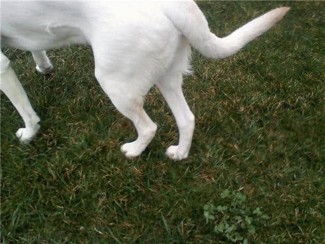 Hip Dysplasia Gait
